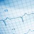 Curso Electrocardiografía y Arritmias 40 Hrs - Válido para Ecuador