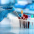 Curso Enfermedades Transmisibles: Vigilancia, Diagnostico Y Tratamiento.